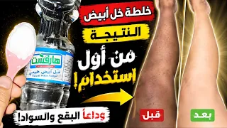 الخل علي النشا ‼️يزيل سواد 20سنة‼️تبييض الوجه والجسم والمناطق الحساسة في5 دقائق فقط‼️