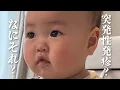 Download Lagu 【突発性発疹】あたちのツヤ肌が・・・！