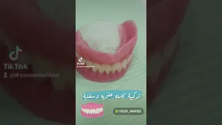 تركيبات متحركة طقم أسنان كامل للفكين 