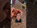 Try this if you have ongoing thumb pain from holding your phone too much