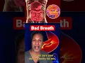 Download Lagu Finally, A Reason For Your Bad Breath! #DrReveals