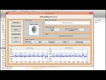 ECG Steganography matlab project source code