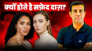 सफ़ेद दाग होने  के 5 कारण !! कैसे रोक सकते है ? How to control Vitiligo? Best Solution #skincare