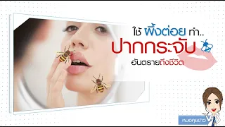 ถ้าโดนผึ้งต่อยแล้วควรทำอย่างไรในเบื้องต้น