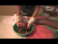 Download Lagu Examining the Placenta - Childbirth Series