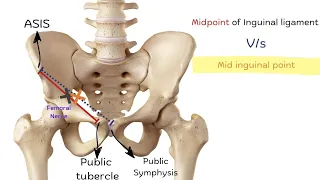 Mid-Inguinal Point vs Midpoint of Inguinal Ligament Inguinal Landmarks Simplified