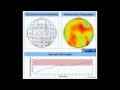 Mental Fatigue Monitoring Using Connectivity-based EEG Analysis