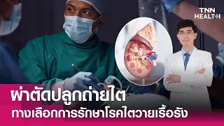 โรคไตวายเรื้อรังเกิดจากสาเหตุอะไรบ้าง