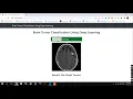 Brain Tumor detection CNN FLASK