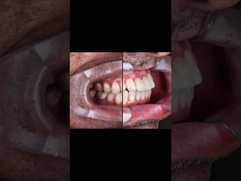 Smile design video testimonial