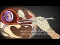 Download Lagu الإجهاض الجراحي في الثلث الأول يدعا الشفط D \u0026 C توسع وجرف