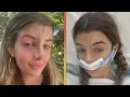 Sami Sheen Shares Her PAINFUL Nose Job Surgery