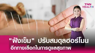 ใครควรหลีกเลี่ยงการฝังเข็ม