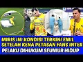 Lagu MIRIS INI KONDISI TERKINI EMIL SETELAH KENA PETASAN FANS INTER❗PELAKU DIHUKUM SEUMUR HIDUP