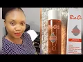 My Experience with Bio Oil Review and how to use for best results
