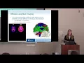 Advanced diffusion MRI methods for studying white matter integrity in Aphasia Emilie McKinnon