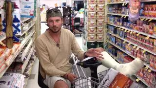 Atticus Update 19: Broken Ankle Blues