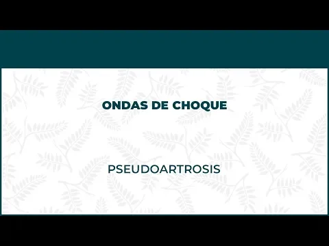 Pseudoartrosis. Ondas De Choque - FisioClinics Madrid