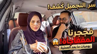 اللي حصلي بسبب عمليات التجميل اللي في وشي !🥲 الحمدلله 