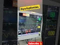 Download Lagu Dysrhythmias | Bradycardia | #ICU #emergency #cardio #shorts #viral