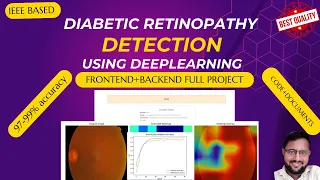 Diabetic Retinopathy Detection Using Deep Learning Python Final Year IEEE Project 2025-2026