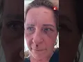 Download Lagu Vårdbiträdet Åsa grovt misshandlad av patient: ”Kastade mig som en trasdocka”
