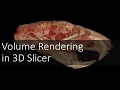 Volume Rendering in 3D Slicer Introduction to Digital Preparation 9