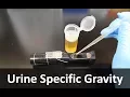 Urine Specific Gravity Refractometer