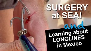 SURGERY At Sea! And Learning About Longlines In Mexico | Sailing with Six | S2 E14