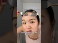 Download Lagu How to pop your pimple correctly 🫣 #acne #skincare #clearskin