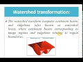 Watershed Transformation Meyer s Watershed Algorithm for Image Segmentation