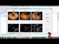 Saliency based Ulcer Detection for Wireless Capsule Endoscopy Diagnosis
