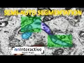 How to segment your vEM Semi-automatic segmentation and ground truth using nnInteractive