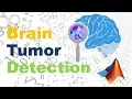 Brain Tumor Detection using matlab with GUI