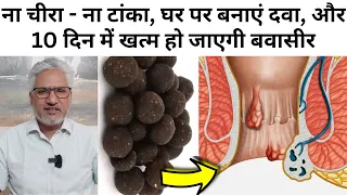 ना चीरा - ना टांका, घर पर बनाएं दवा, और 10 दिन में खत्म हो जाएगी बवासीर | Home remedy for Pile