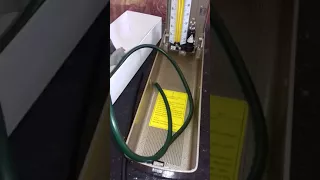 حل مشكلة تقطع الزئبق في جهاز الضغط الزئبقي دندنها