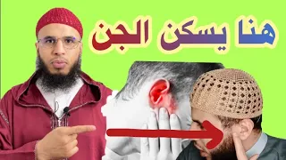 علاج التصفير وطنين الأذنين مع الراقي أحمد السوسي  علاج التصفير وطنين الأذنين مع الراقي أحمد السوسي
