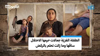 الطفلة جمالات ضبان تكافح بعد أن بتر الاحتلال ساقها في غزة وتحلم بالعودة إلى اللعب