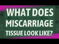 What does miscarriage tissue look like