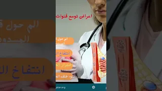 اعراض توسع قناة الحليب امراض نسا إنسدادقنواتالحليب إلتهابقنواتالحليب ماهومرضتوسعقنواتالثدي 