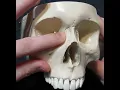 Identification of Bony Landmarks - Maxilla Bone Skull