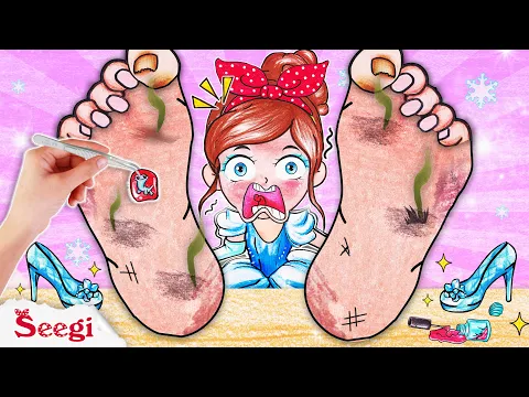 Download MP3 [🌟paper diy🌟] Helping CINDERELLA Treatment for Ingrown Toenail | Foot Treatment