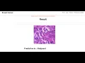 Breast Cancer Classification using CNN with Transfer Learning Models Machine Learning IEEE Project