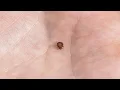 Download Lagu how to get rid of fleas in yard