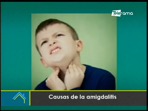 Causas de la amigdalitis
