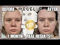 Download Lagu NEW Megelin Laser LED Mask Review | Does It Really Work? 1 Month Real Results🔥✨ | Clare Walch