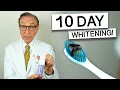 Hismile Purple Toothpaste for 10 Days - Dentist Review
