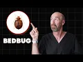 Doctor Explains BEDBUGS-including BITES TREATMENT REMOVAL