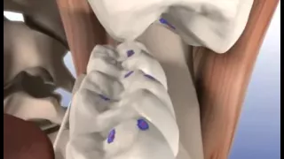 Articulating paper to adjust occlusion 2 step technique