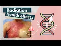 Side effects of Radiation Deterministic vs Stochastic effects